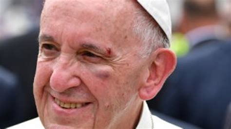 P­a­p­a­,­ ­K­o­l­o­m­b­i­y­a­ ­z­i­y­a­r­e­t­i­n­d­e­ ­k­a­z­a­ ­g­e­ç­i­r­d­i­